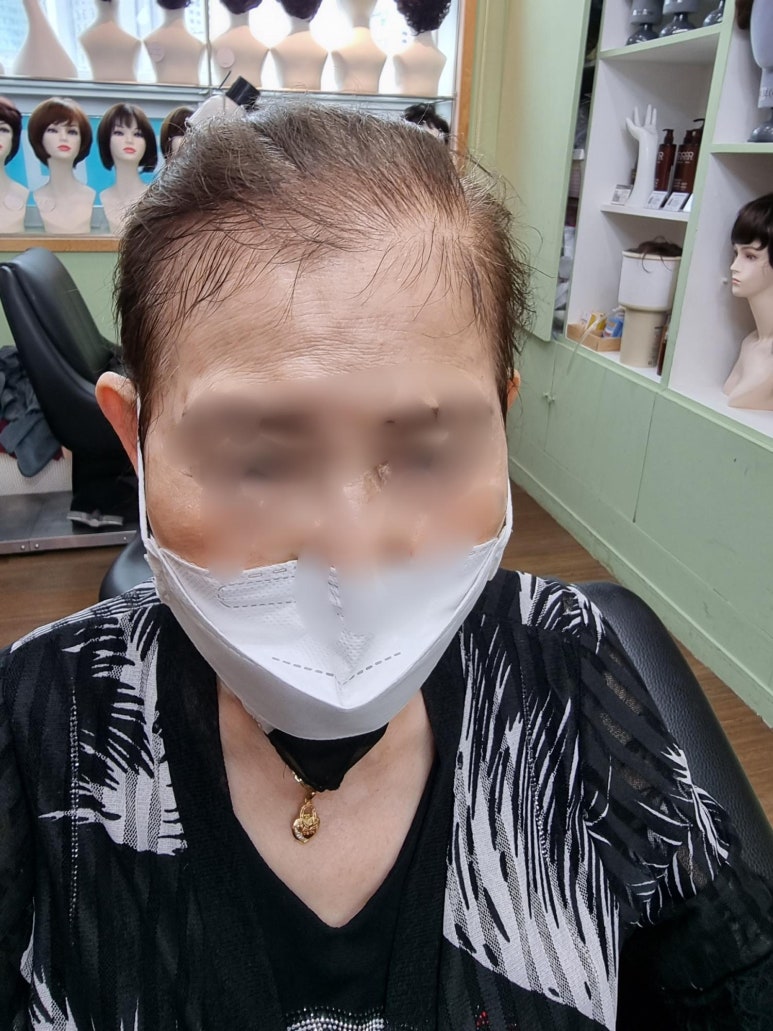 영등포가발 두해 이미지