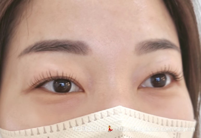 요이뷰티 이미지