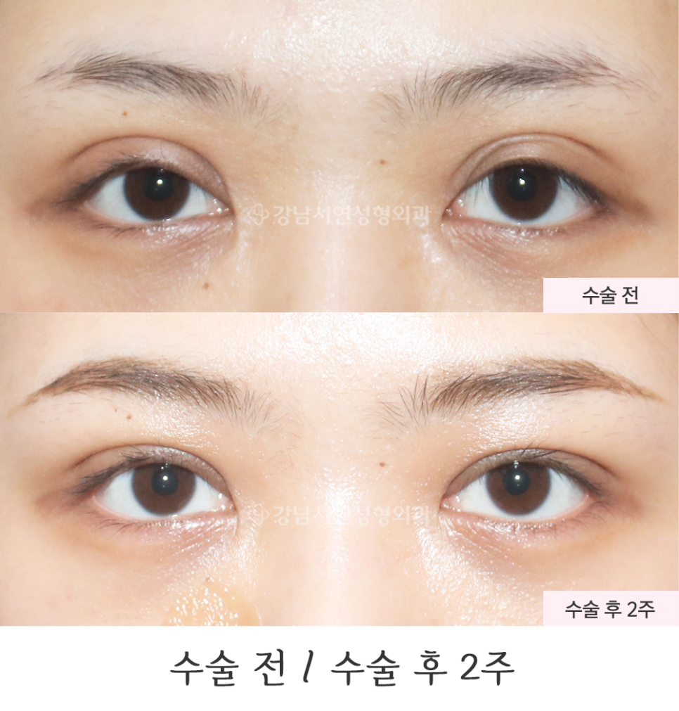 서연성형외과의원 이미지
