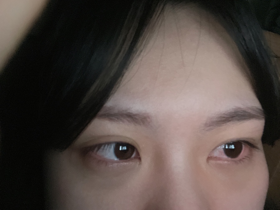 옐로우성형외과의원 이미지