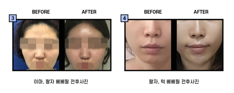페이스피부과의원 이미지