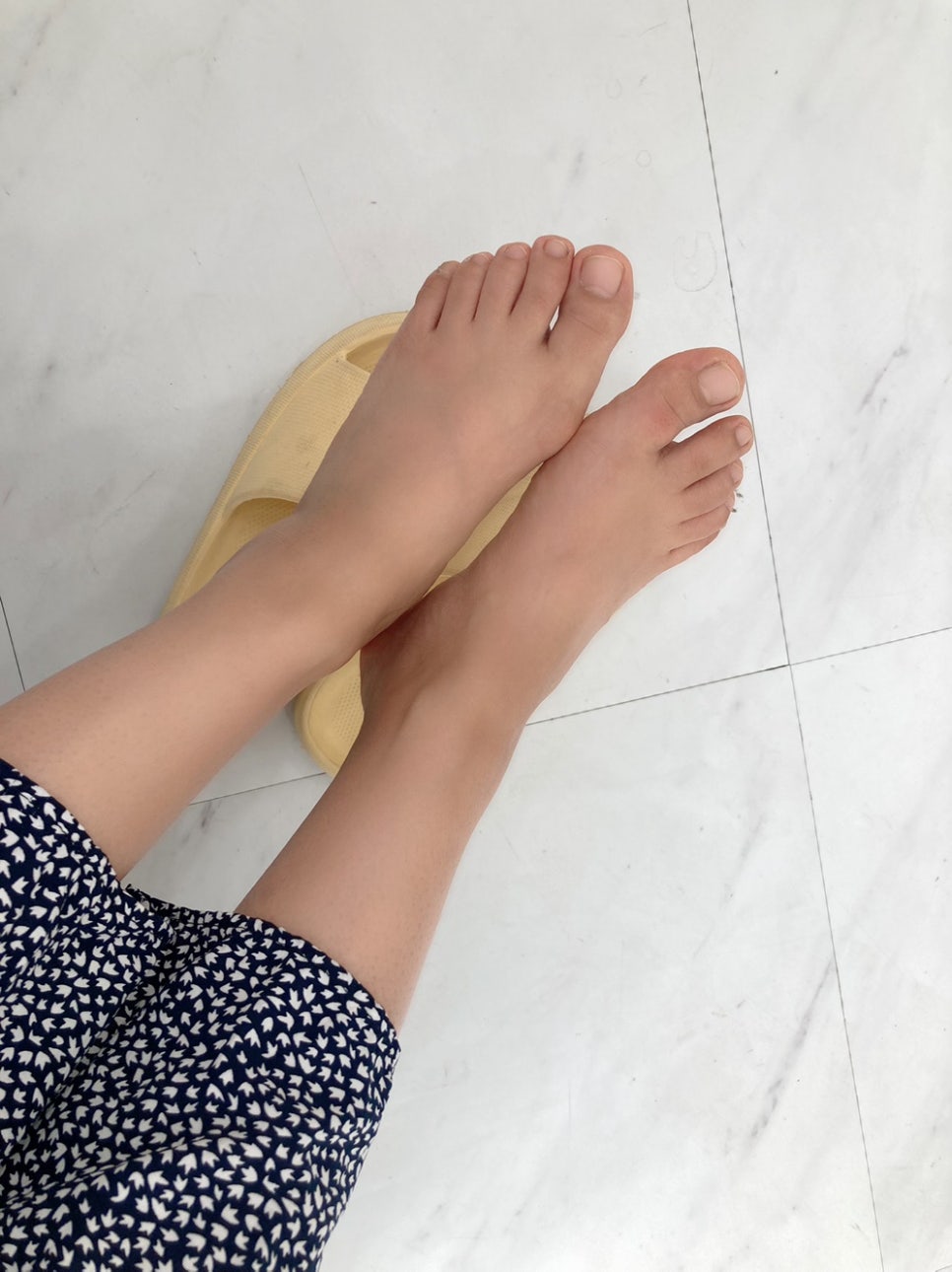달몽네일 이미지