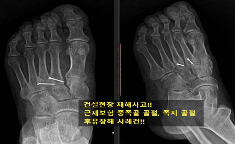 장원손해사정행정사사무소 이미지
