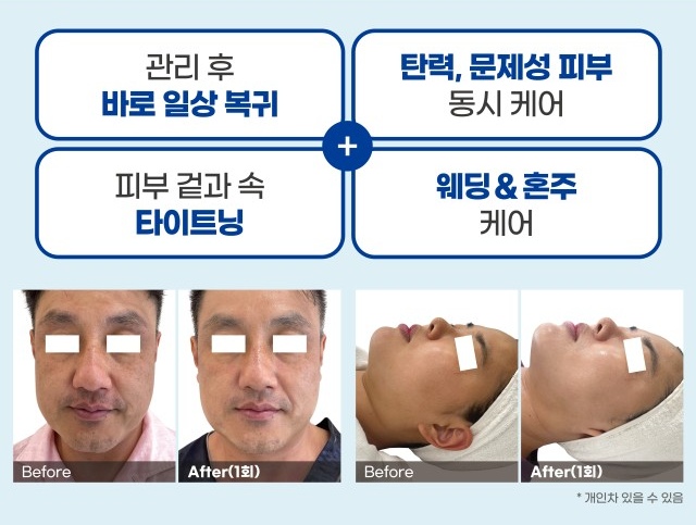 소노뷰티 이미지