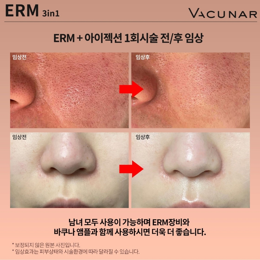 애플스킨 이미지