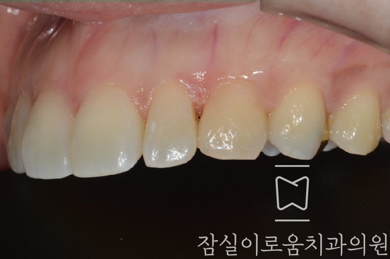 잠실이로움치과 이미지