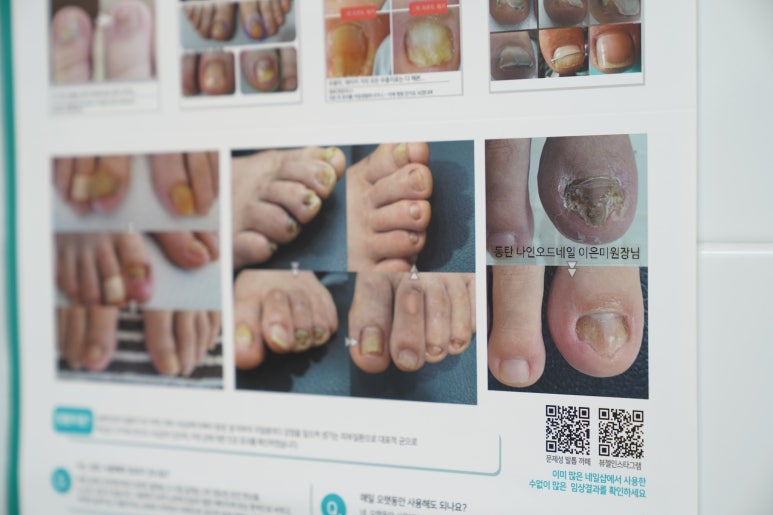 오드네일 이미지