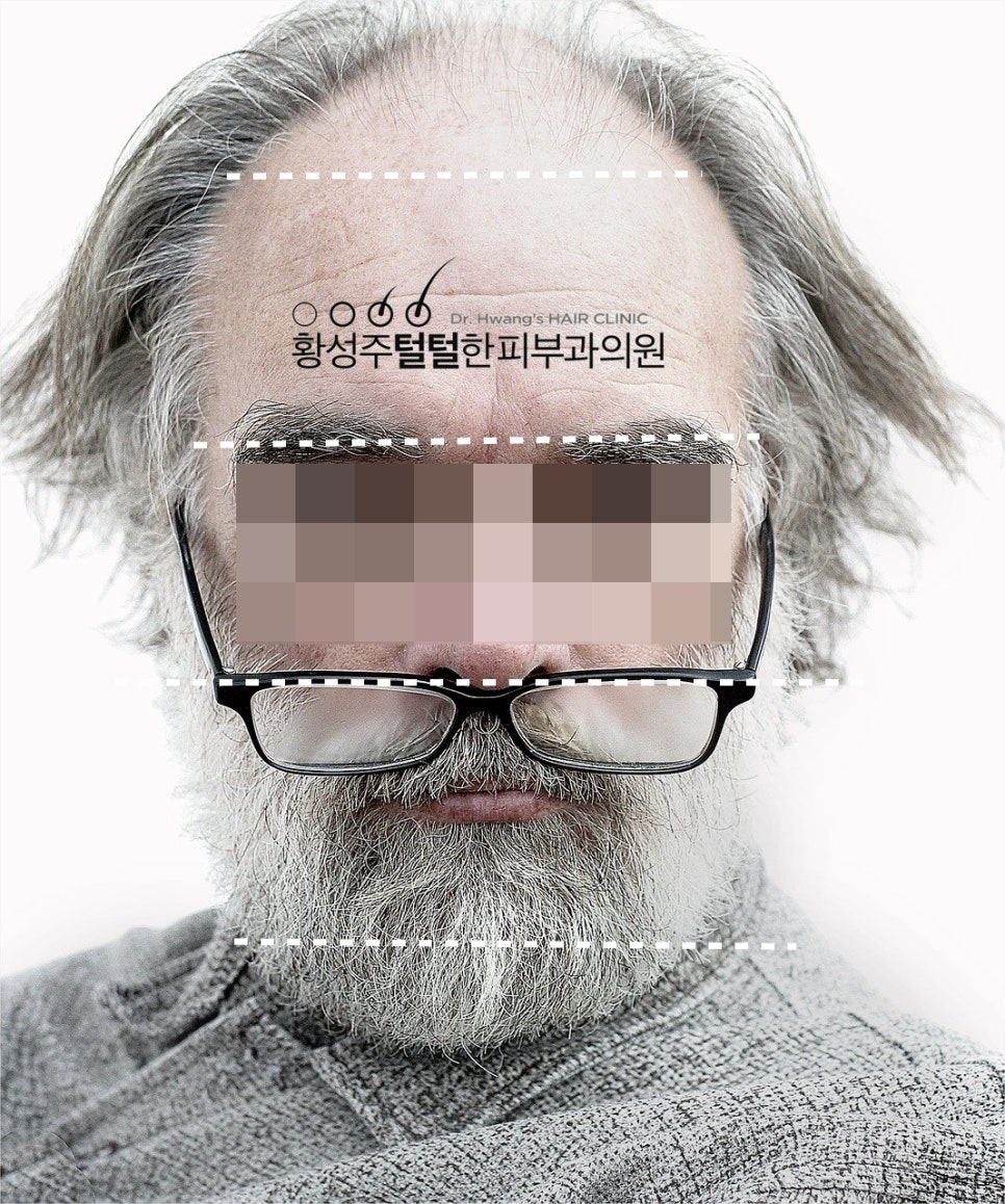 코라인 헤어 이미지