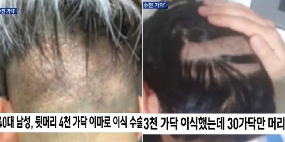 시크맨 이미지
