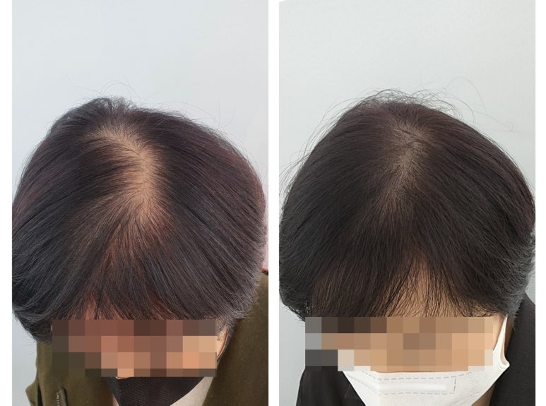 유나뷰티 이미지