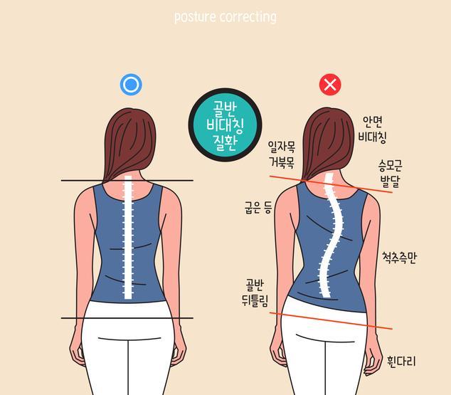 비앤채 이미지