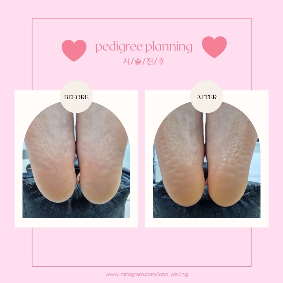이노플래닝 이미지
