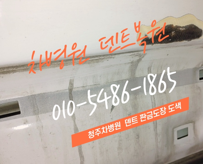 차병원덴트칼라매치 이미지