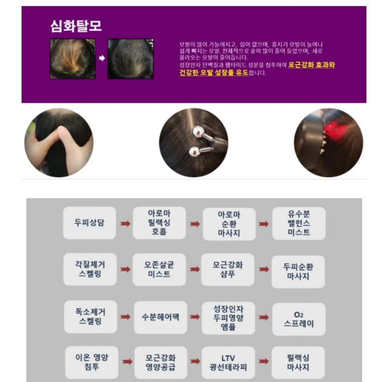 이안두피탈모 이미지
