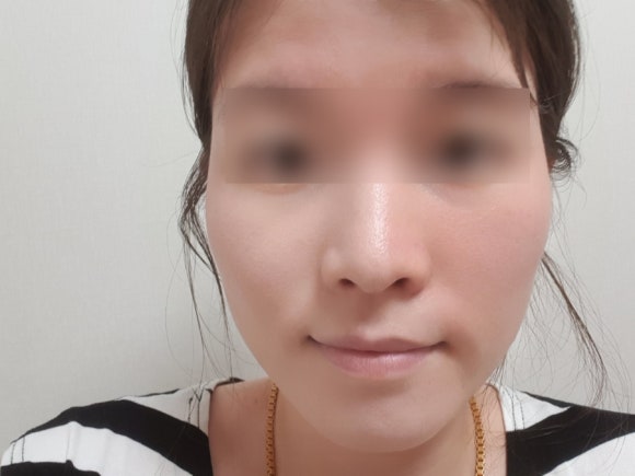 인셀덤서서울 이미지