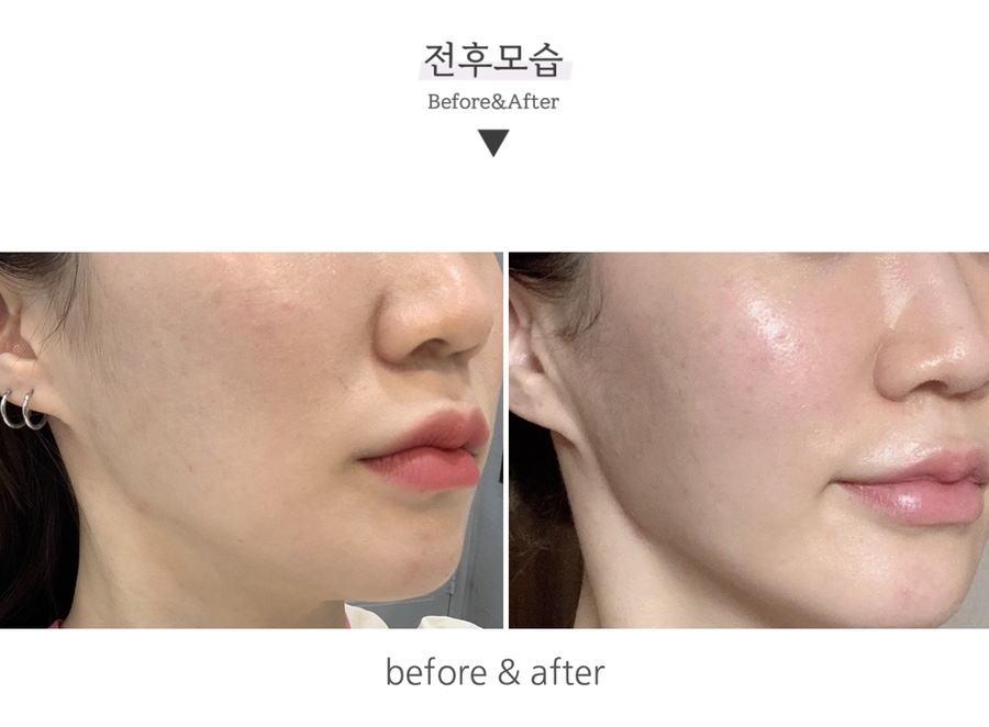 인셀덤 인천대리점 이미지