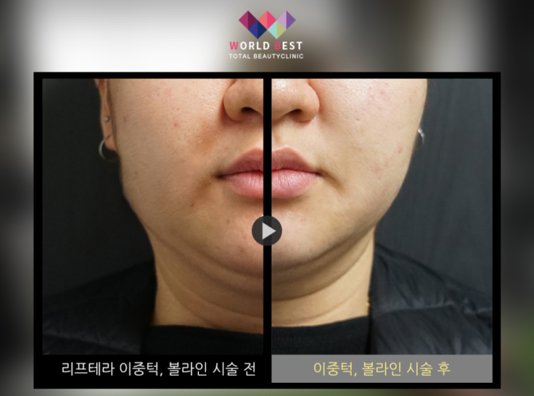 베스트피부과의원 이미지