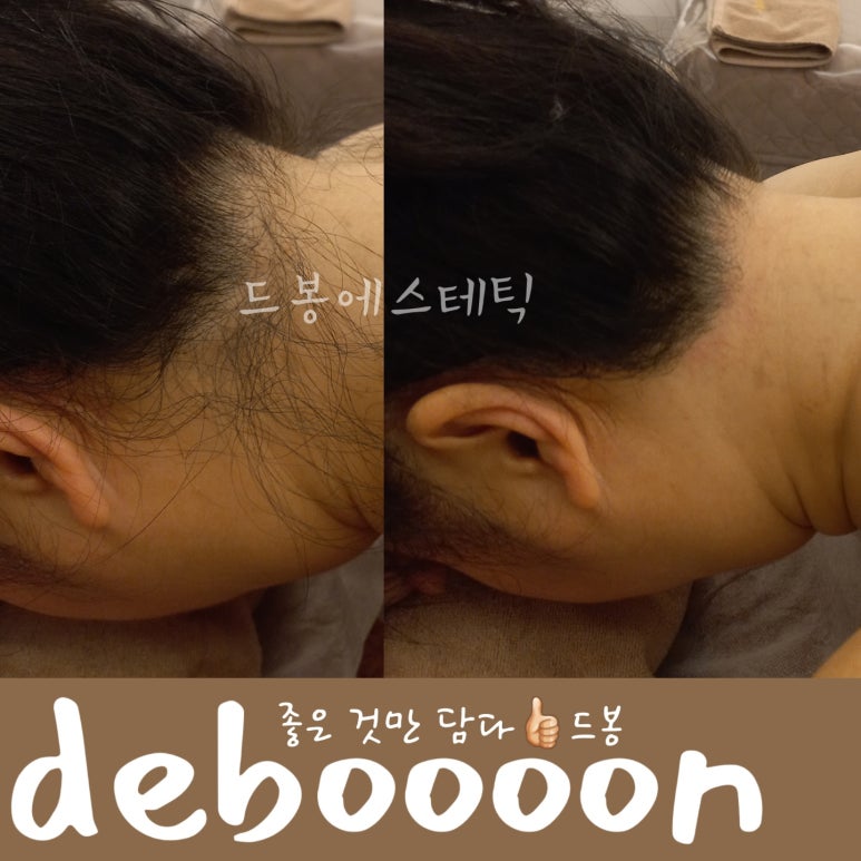 왁싱드봉 이미지