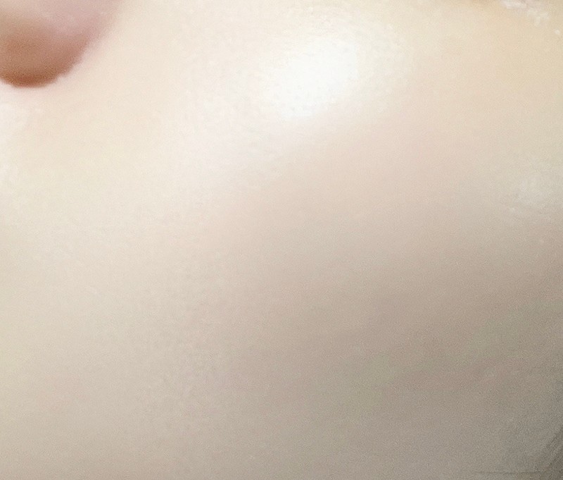 피부힐링 이미지