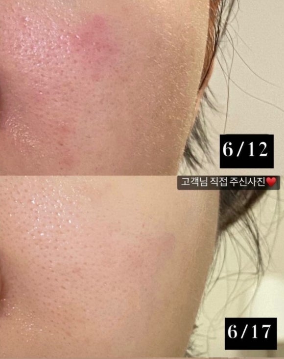 수니뷰티 이미지