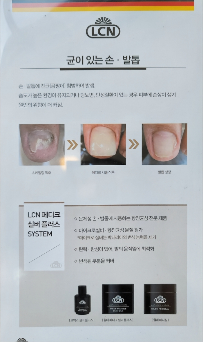 네일 더, 눈부심 이미지