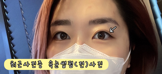 스마일데이지(Smile Daisy) 이미지
