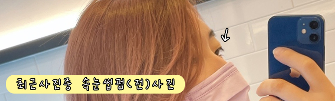 스마일데이지(Smile Daisy) 이미지