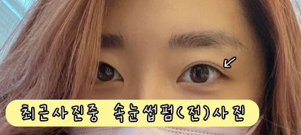 스마일데이지(Smile Daisy) 이미지