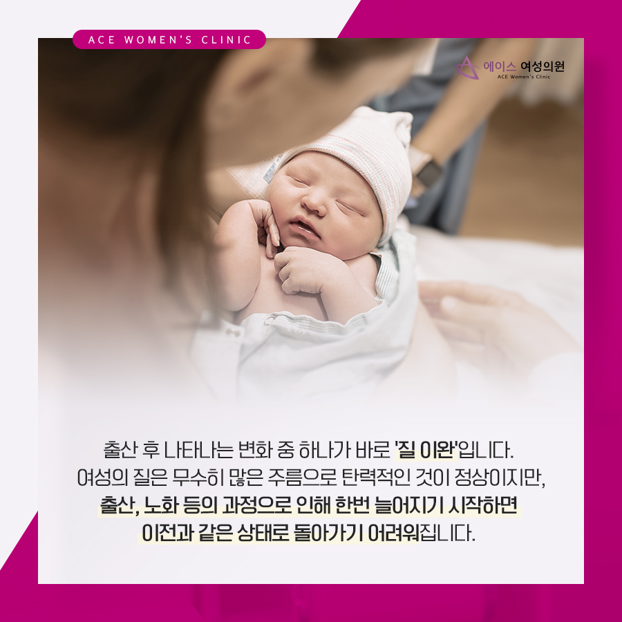 에이스여성의원 이미지