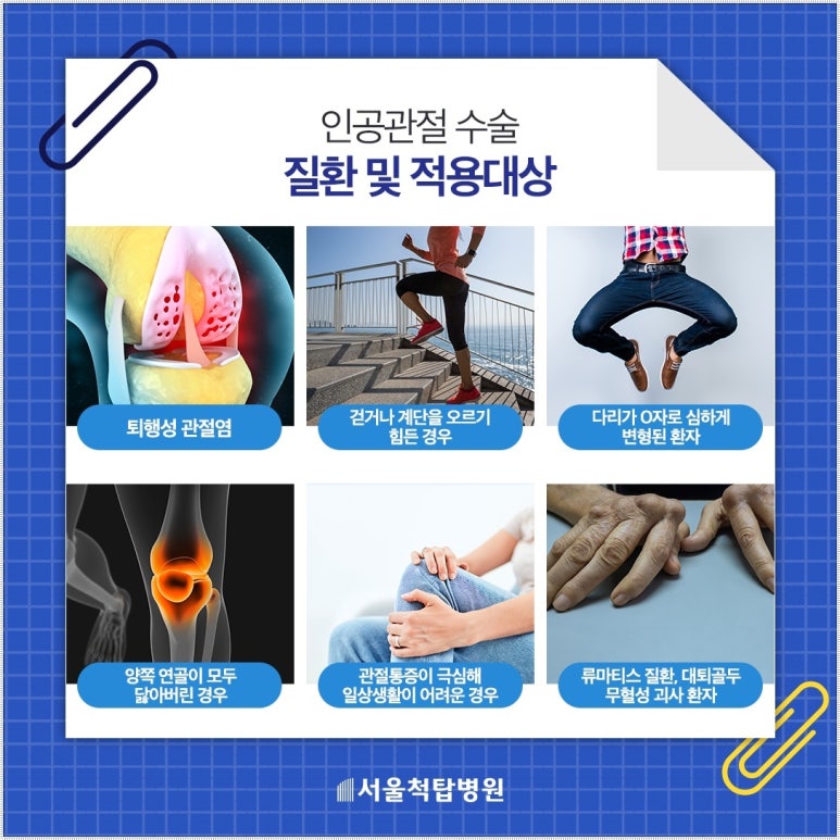 척탑병원 이미지
