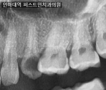 퍼스트민치과의원 이미지