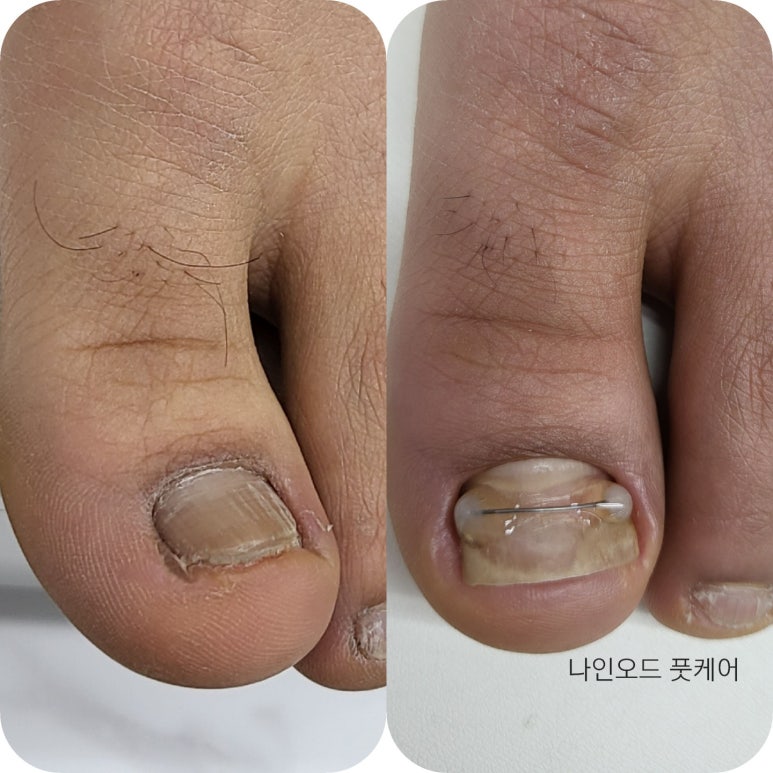 네일나인 이미지