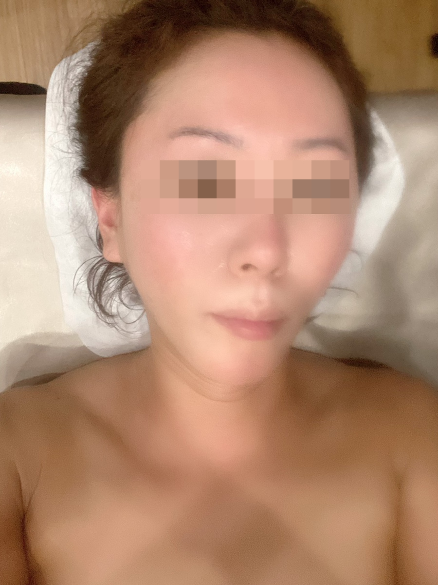 영에이스테라피 이미지