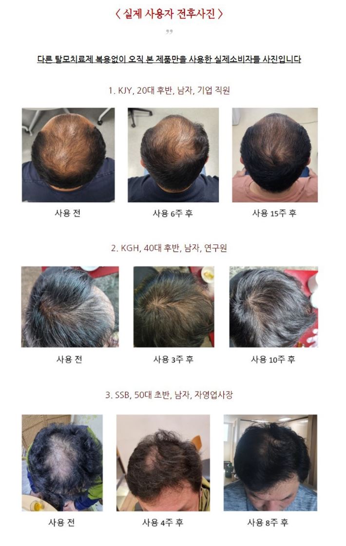 주식회사 탈모연구소 이미지