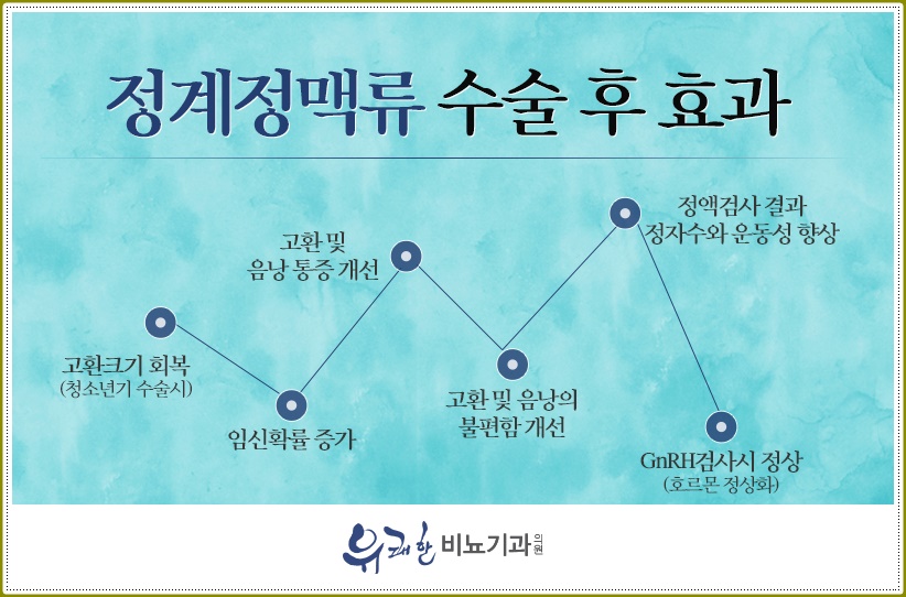 서비뇨기과 이미지