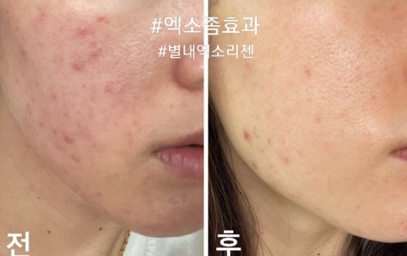 수니뷰티 이미지