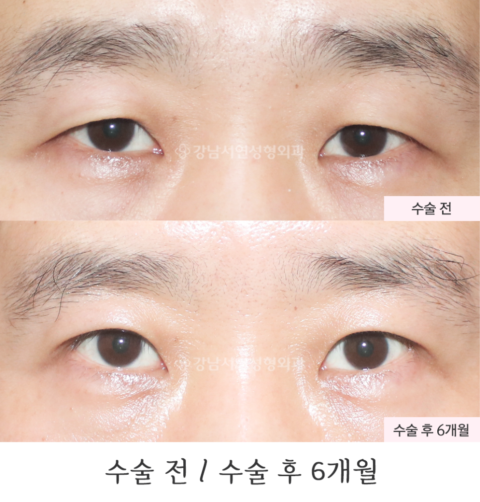서연성형외과의원 이미지