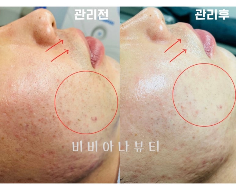 비비아나뷰티 이미지