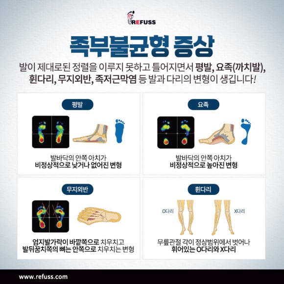레푸스전주 이미지