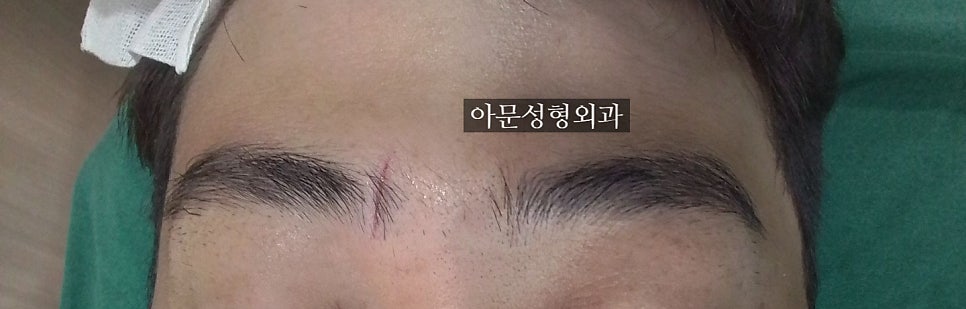 아문성형외과의원 이미지