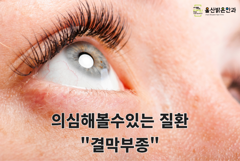 울산제일안과 이미지