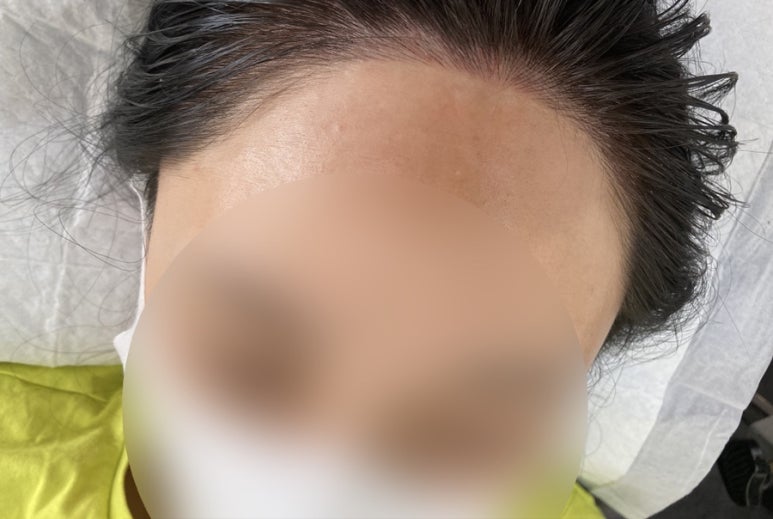 그린헤어아트 이미지
