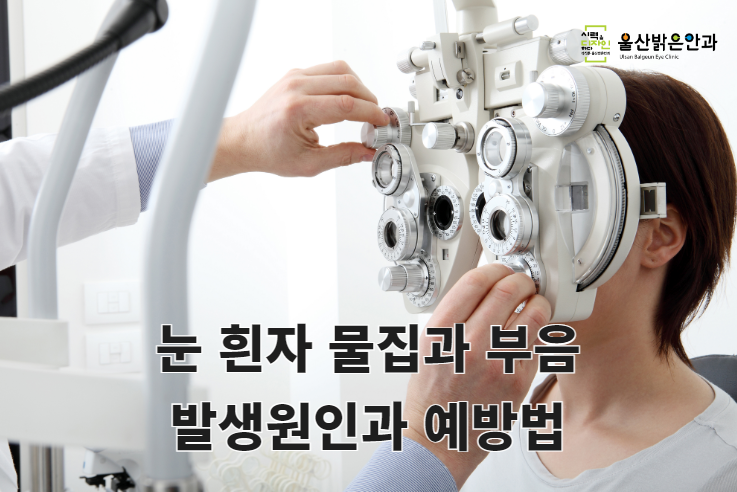 울산제일안과 이미지