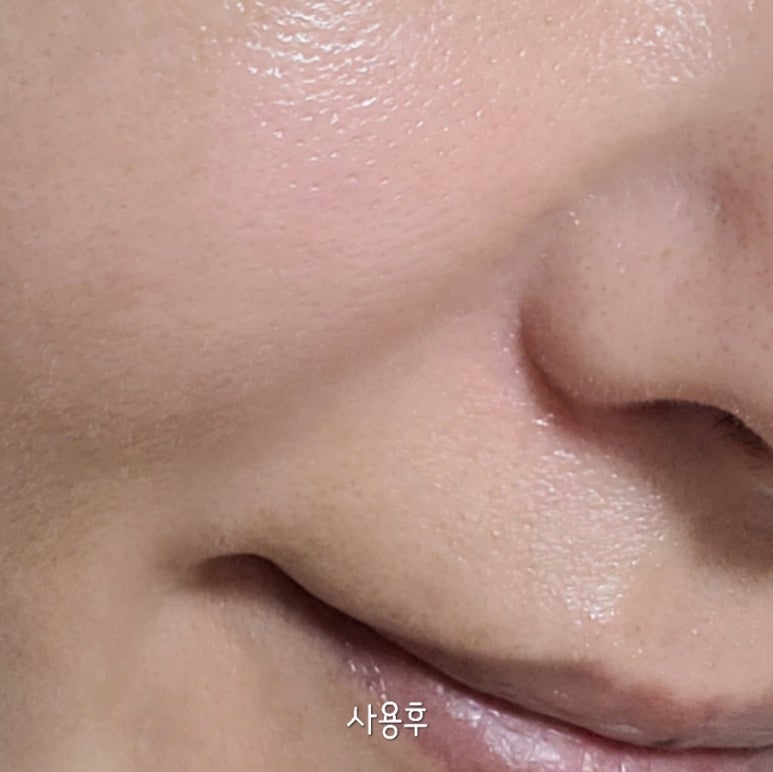 유알픽 이미지
