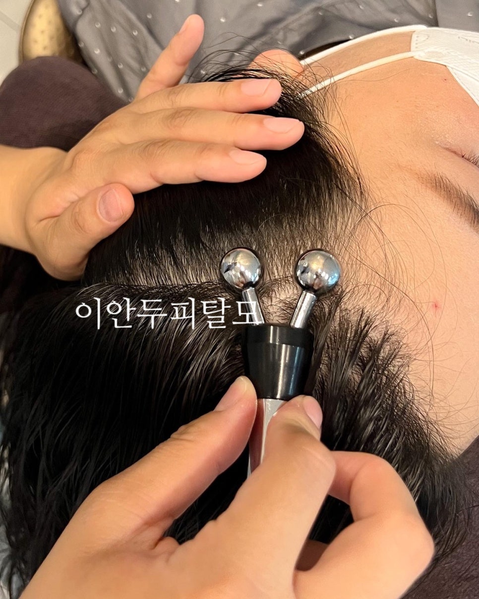 이안두피탈모 이미지