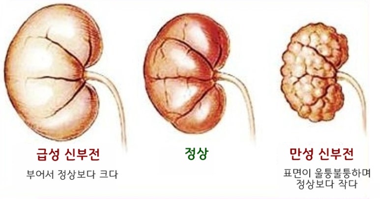 신장군집 이미지