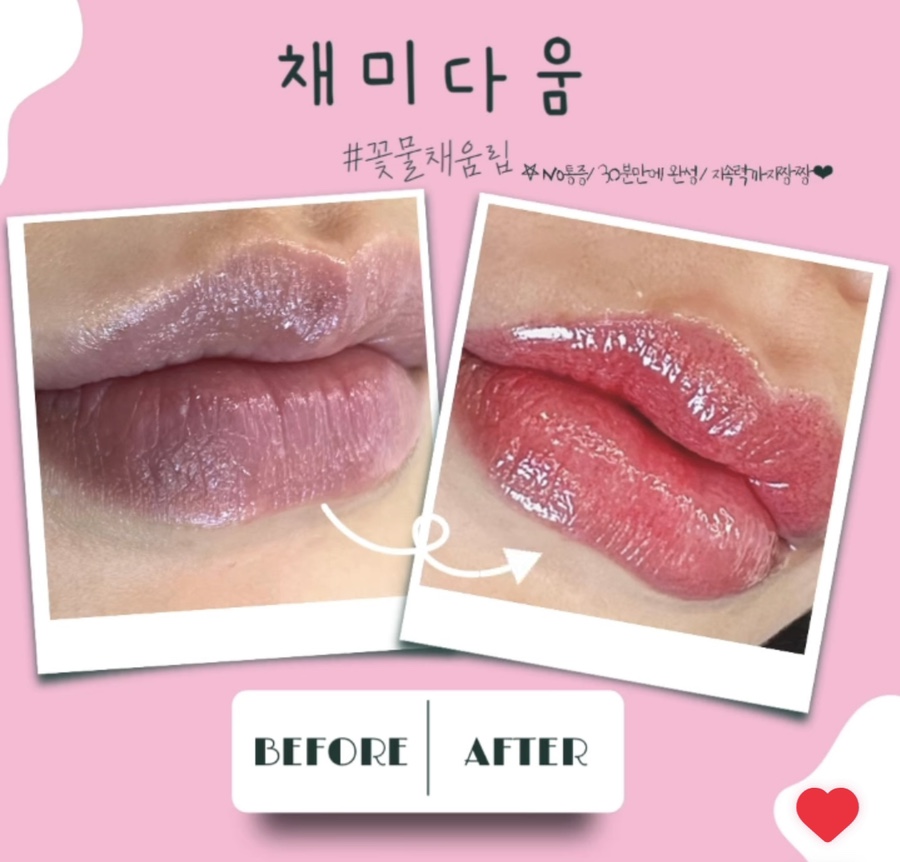 채미다움 이미지
