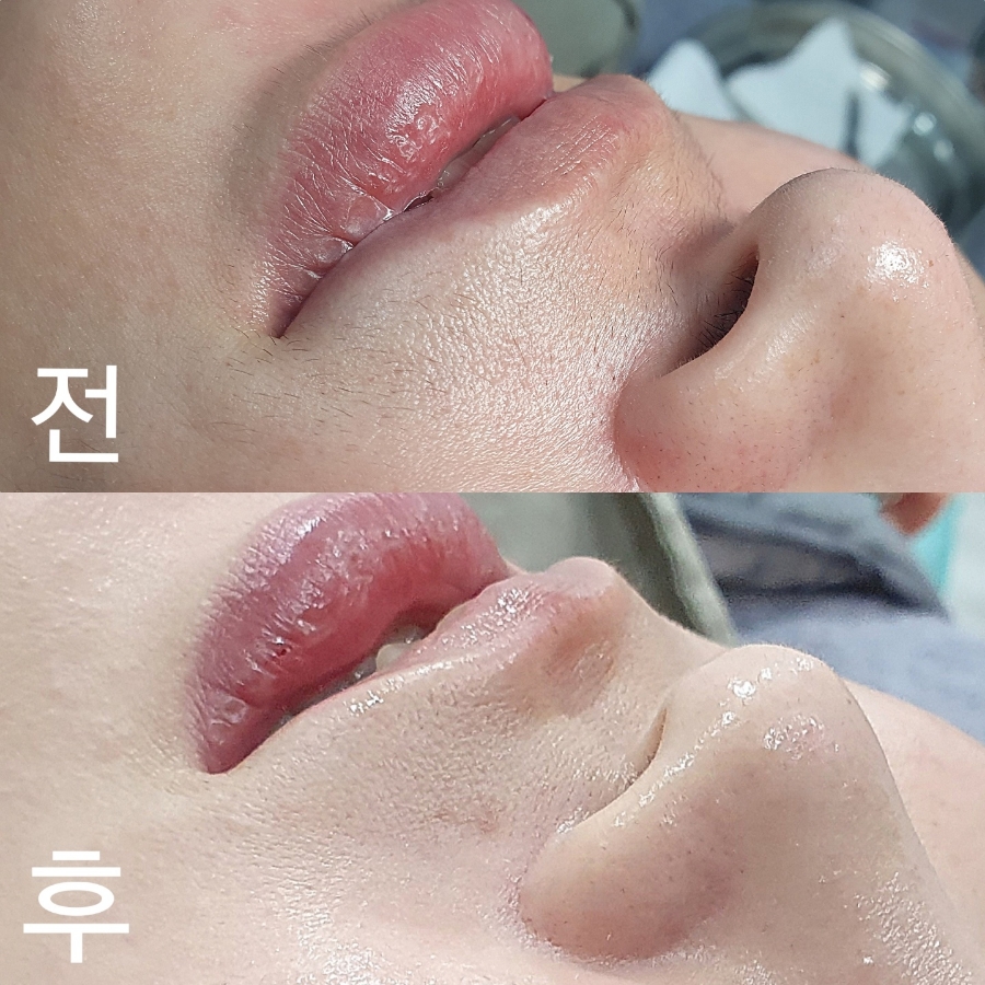 수앤수스킨케어 이미지