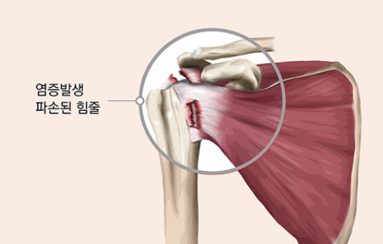 포레스트운동센터 이미지