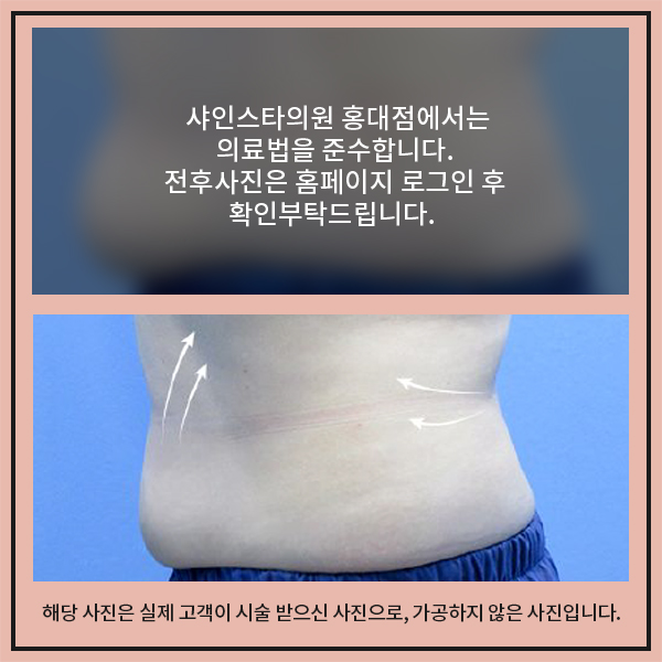 스타피부과의원 이미지